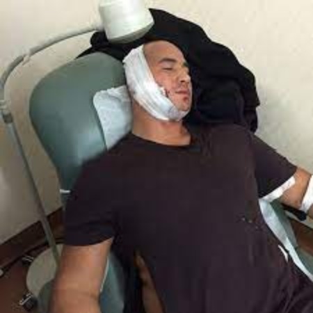 Natalie Guercio's boyfriend London Rene was slashed in the face